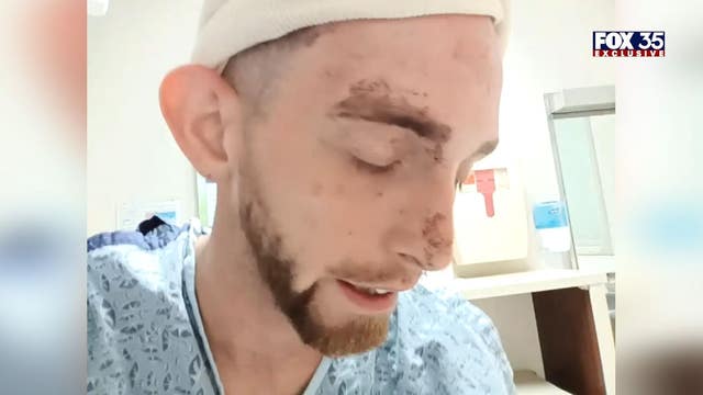 Club worker shot in downtown Orlando shooting wants more security: 'Stuff like this should not be happening'