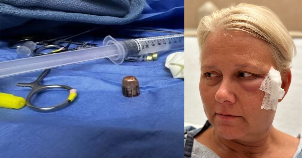 Woman struck in face by stray bullet at Florida home during New Year's ...