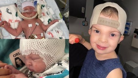 Florida baby born with part of his brain exposed now flourishing: 'A lot of scary moments'