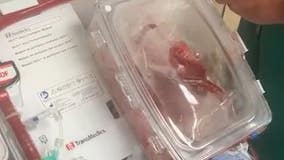 'Heart in a Box' increases viability for donated organs