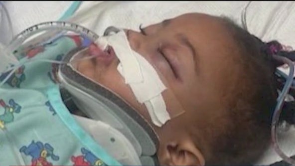 Speed bump reinstalled after hit and run crash injures toddler in Daytona Beach