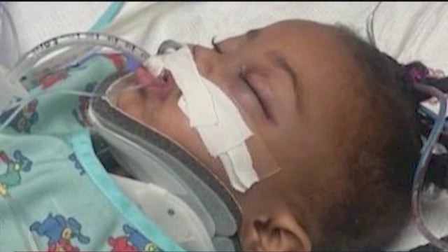 Speed bump reinstalled after hit and run crash injures toddler in Daytona Beach