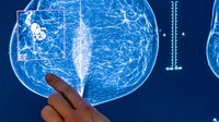 Inside the Mammogram Experience: Patient, radiologist explain what screening is really like