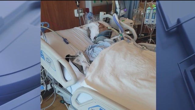 Alachua County grandmother recovering after losing leg in dog attack