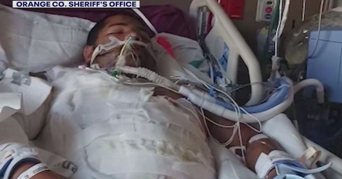 Orlando man spent 3 months in hospital after surviving fiery crash ...