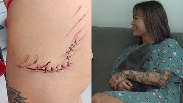 Shark bites woman near St. Pete Pier: ‘It was the perfect cocktail for the perfect storm’