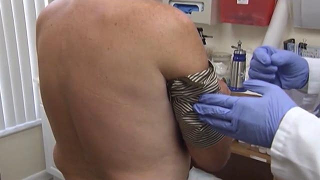 Leprosy in Florida: How do you know if you have the infection?