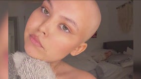 California teen shares story for Childhood Cancer Awareness Month