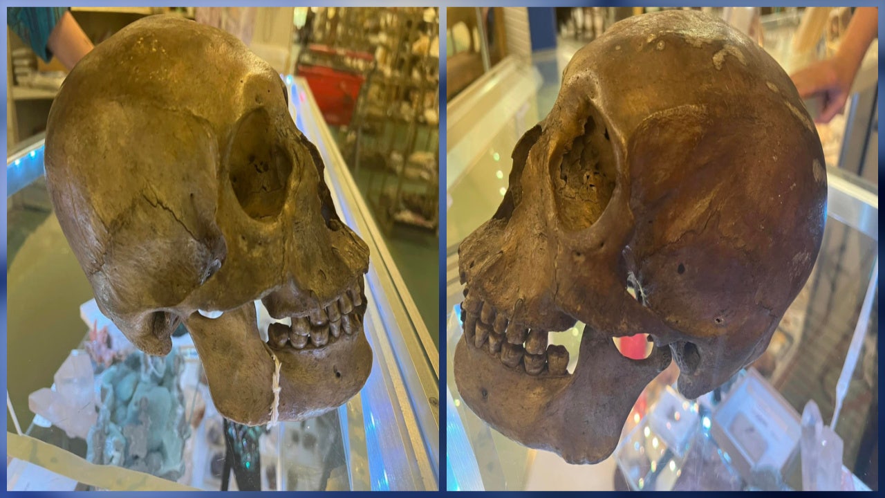 A store near me sells legitimate, real human skulls : r
