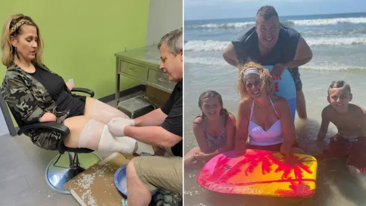 Ohio woman who lost all four limbs to flu complications speaks out to raise awareness - Vimarsana News