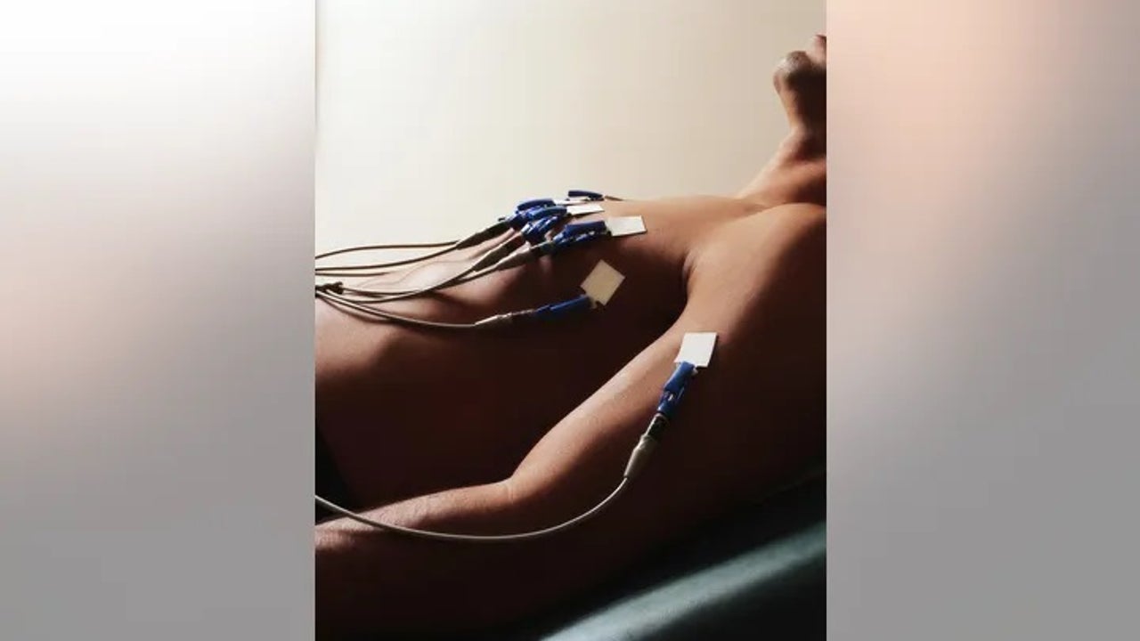 Doctors say AI is a 'game-changer' for number 1 killer of Americans - Vimarsana News