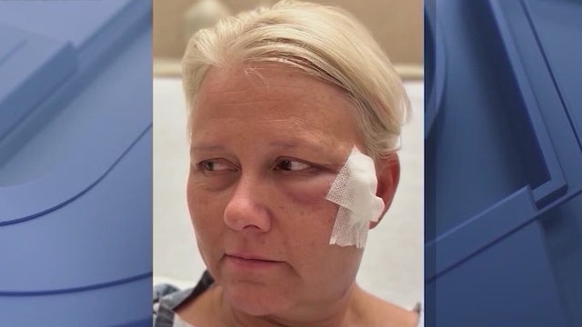 'I was extremely lucky': Florida woman hit by celebratory bullet last NYE has warning