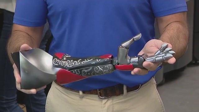 UCF-linked Limbitless Solutions using AI to help design prosthetics for kids, teens