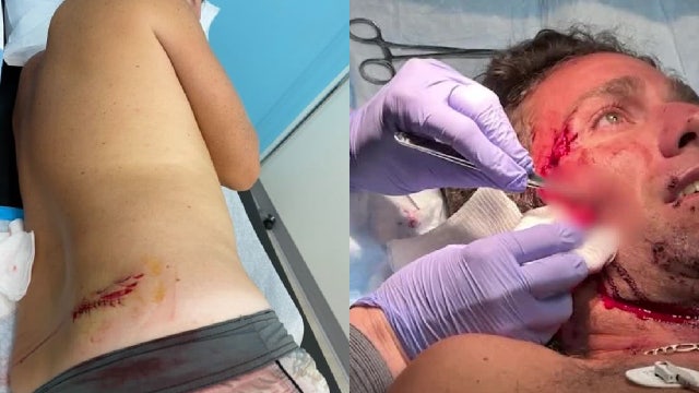 Florida ranked highest in world for shark bites in 2023, report says: See what county had the most