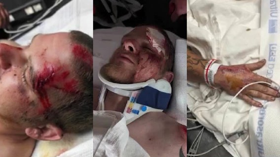 'What if you killed somebody?': Police searching for driver who hit, injured Palm Bay motorcyclist