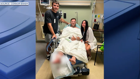 Man bitten by shark in Florida Keys while spearfishing; friend saved his life