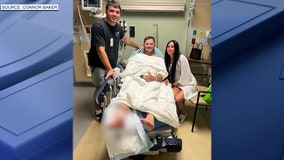 Florida shark bite victim recounts attack at New Smyrna Beach: ‘I couldn't believe my eyes'