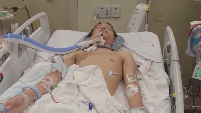 Teen injured in accidental shooting remains in critical condition, family says