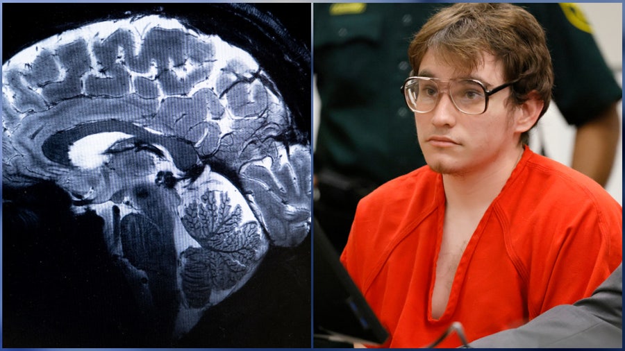 Florida mass school shooter agrees to donate brain to science in stunning settlement