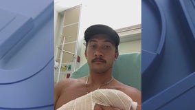 Florida firefighter bitten by shark at New Smyrna Beach