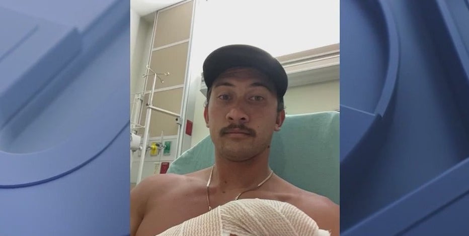 Florida firefighter bitten by shark at New Smyrna Beach
