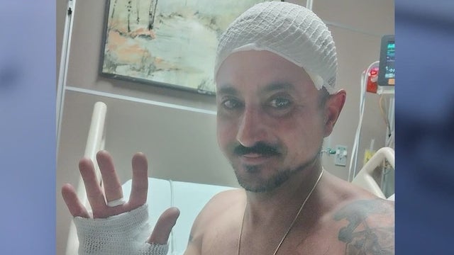 Brevard County rallies around officer caught in house fire