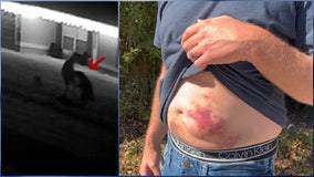 VIDEO: Florida man attacked by bear while trying to save his dog