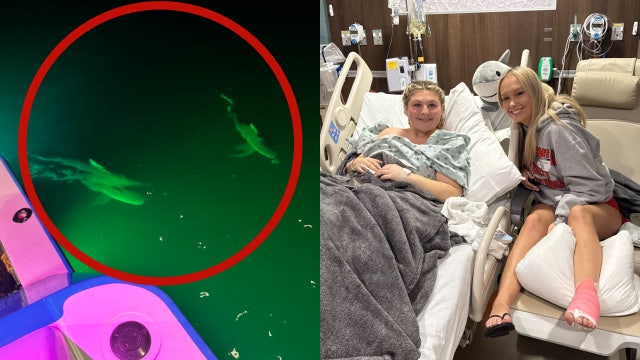 Two Central Florida women survive shark attack during weekend Bahamas trip