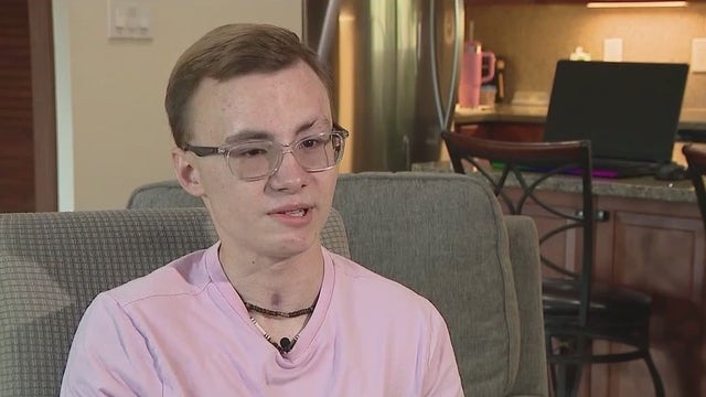 Longwood UCF student, cancer survivor, continues to recover after accident