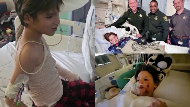 Police host fundraiser for 9-year-old Florida boy burned in campfire accident