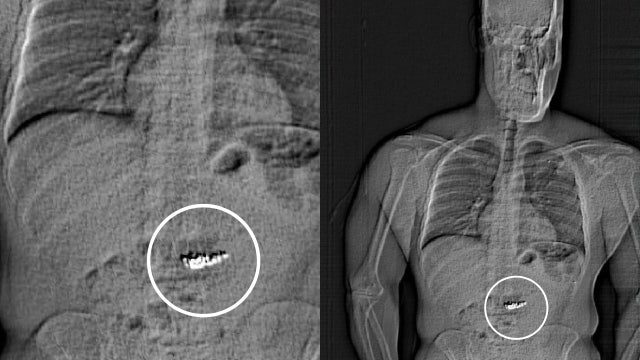 Texas man swallowed $700K in Tiffany earrings during alleged jewelry heist in Orlando, deputies say