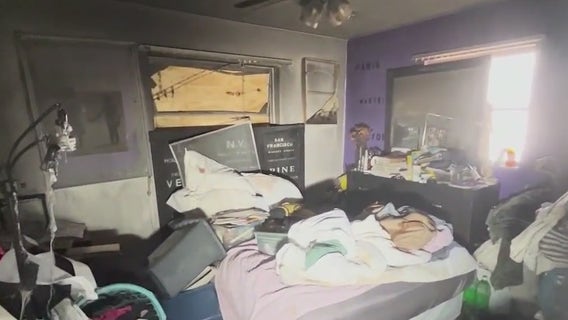 Deputies investigating alleged arson attack in Merritt Island, leaving victim with half her body burned