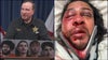4 Florida teens arrested for brutal beating of man, deputies say