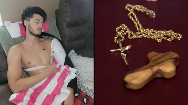 Florida man's cross necklace may have saved his life: 'I thought I was going to die'