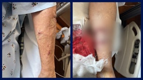 Volusia County woman attacked by 2 dogs while delivering food to Ormond Beach home: Records