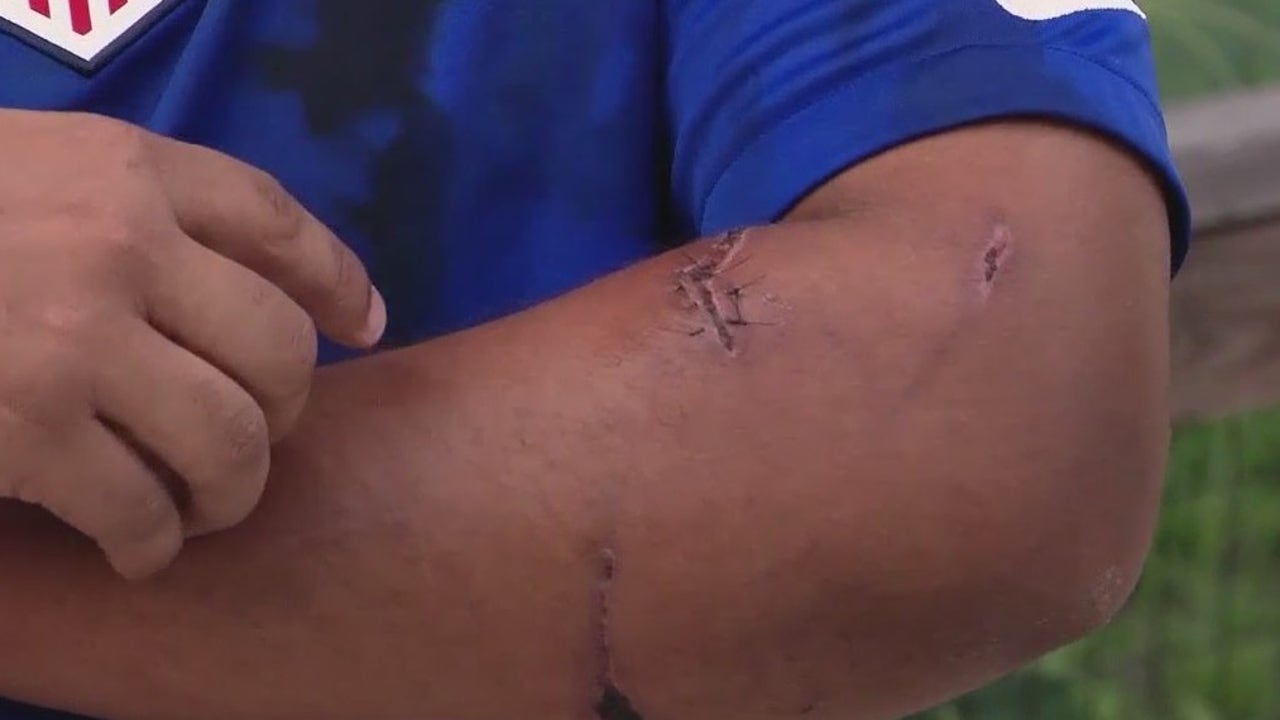 Florida Man Injured by Bear Amid Hunting Resumption
