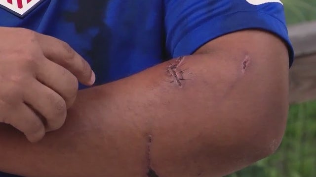 Apopka man fights off bear attack as Florida readies first hunt in decade