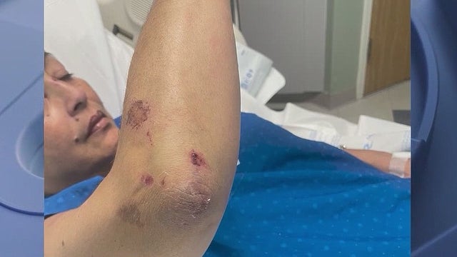 Woman injured chasing alleged purse snatcher outside bakery; suspect arrested