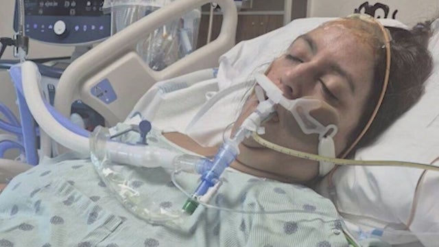 Florida family urges awareness after mother’s sudden brain aneurysm: 'Don't think, it's just a headache'