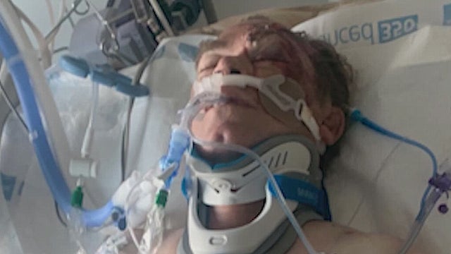 Driver sought after hit-and-run crash leaves 2 motorcyclists critically injured: FHP