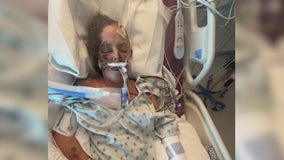 Mom remains hospitalized weeks after Cocoa hit-and-run; suspected driver still at-large