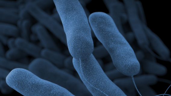 Legionnaires' disease: What is it? How is it spread? Signs and symptoms