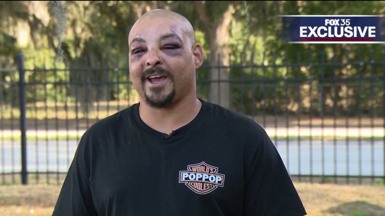 Army veteran injured in 4-on-1 assault at downtown Orlando smoke shop