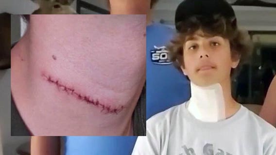Teen survives random throat-slashing attack on Daytona Beach Boardwalk, authorities say