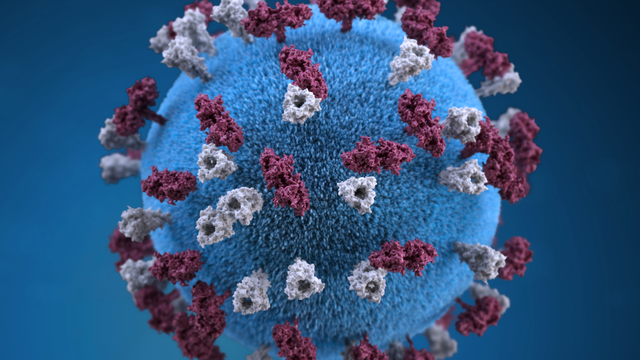 Florida reports 2 measles cases in Orange County: Symptoms, how it spreads