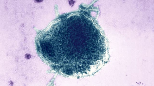 First Central Florida measles case of 2026 confirmed in Osceola County: How does it spread?