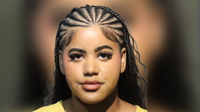 Florida woman allegedly ran unlicensed lip filler business, deputies say