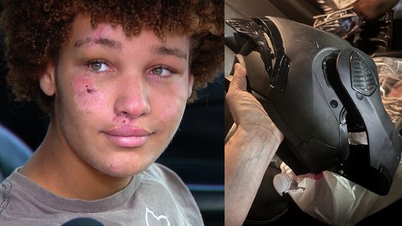 'Just got smacked': Florida 14-year-old credits helmet for saving life in crash