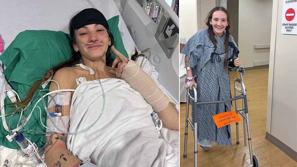 Woman pulled over on Colonial Drive loses leg after being struck by hit-and-run driver