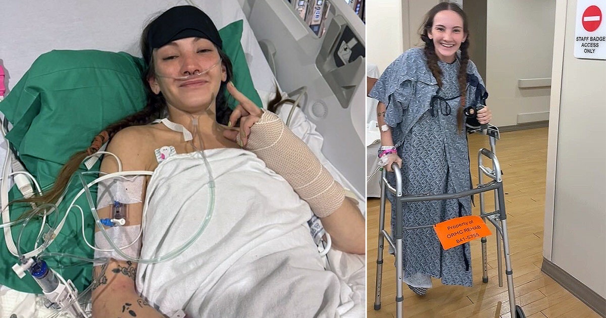Woman pulled over on Colonial Drive loses leg after being struck by hit-and-run driver